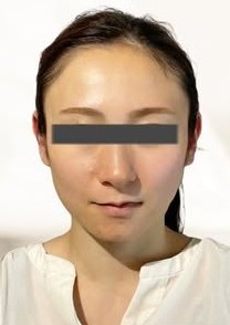 施術後