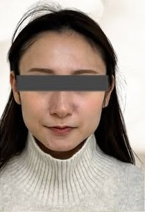 施術前