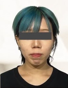 施術後